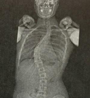 spine curve web