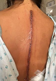 post op web post op web