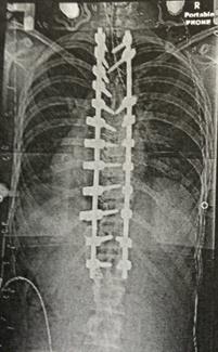 spine pins web spine pins web